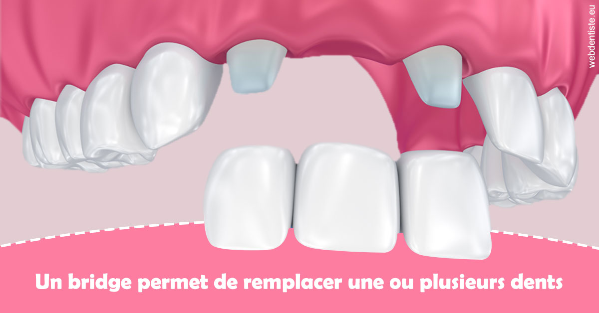 https://dr-atinault-philippe.chirurgiens-dentistes.fr/Bridge remplacer dents 2