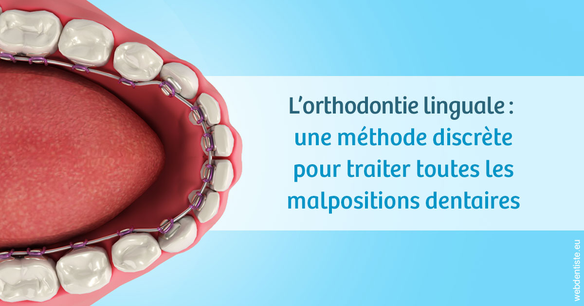 https://dr-atinault-philippe.chirurgiens-dentistes.fr/L'orthodontie linguale 1