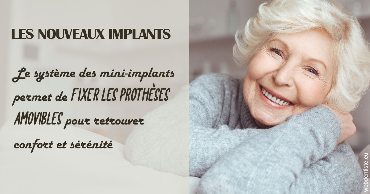 https://dr-atinault-philippe.chirurgiens-dentistes.fr/Les nouveaux implants 1