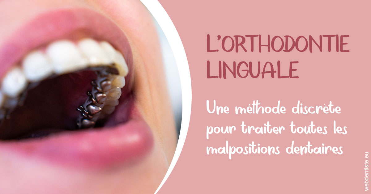 https://dr-atinault-philippe.chirurgiens-dentistes.fr/L'orthodontie linguale 2