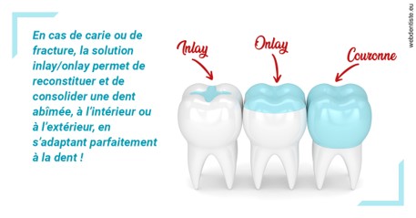 https://dr-atinault-philippe.chirurgiens-dentistes.fr/L'INLAY ou l'ONLAY
