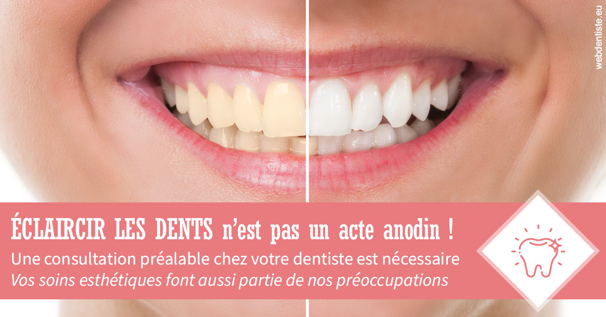 https://dr-atinault-philippe.chirurgiens-dentistes.fr/Eclaircir les dents 1