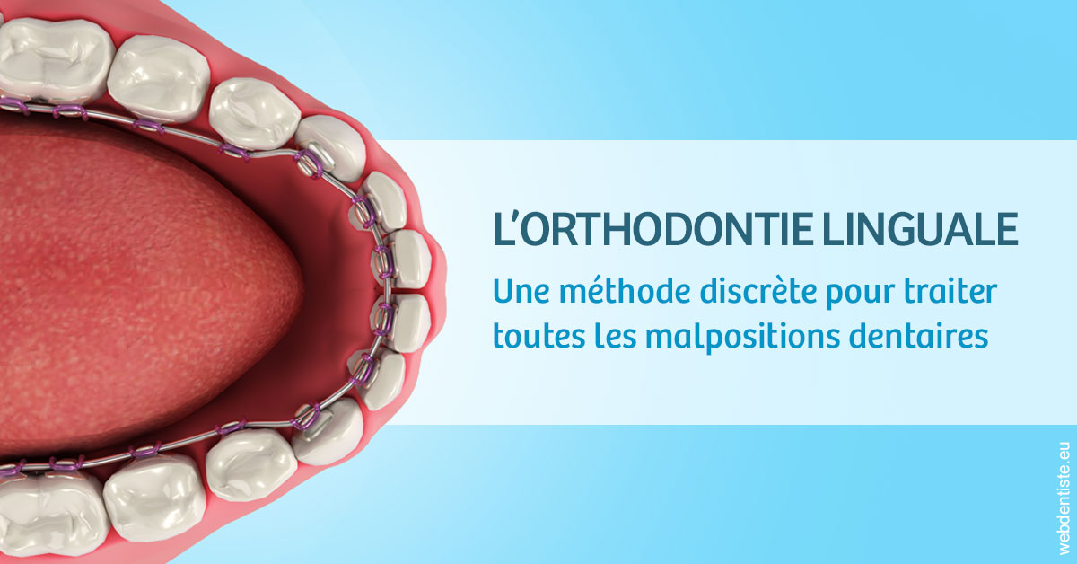 https://dr-atinault-philippe.chirurgiens-dentistes.fr/L'orthodontie linguale 1