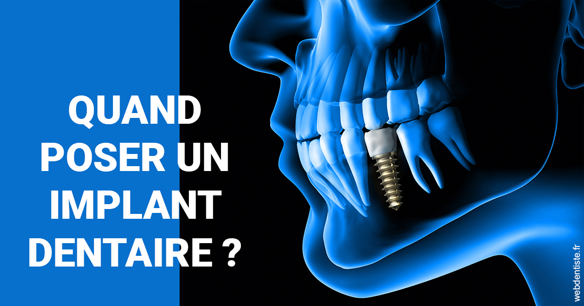 https://dr-atinault-philippe.chirurgiens-dentistes.fr/Les implants 1