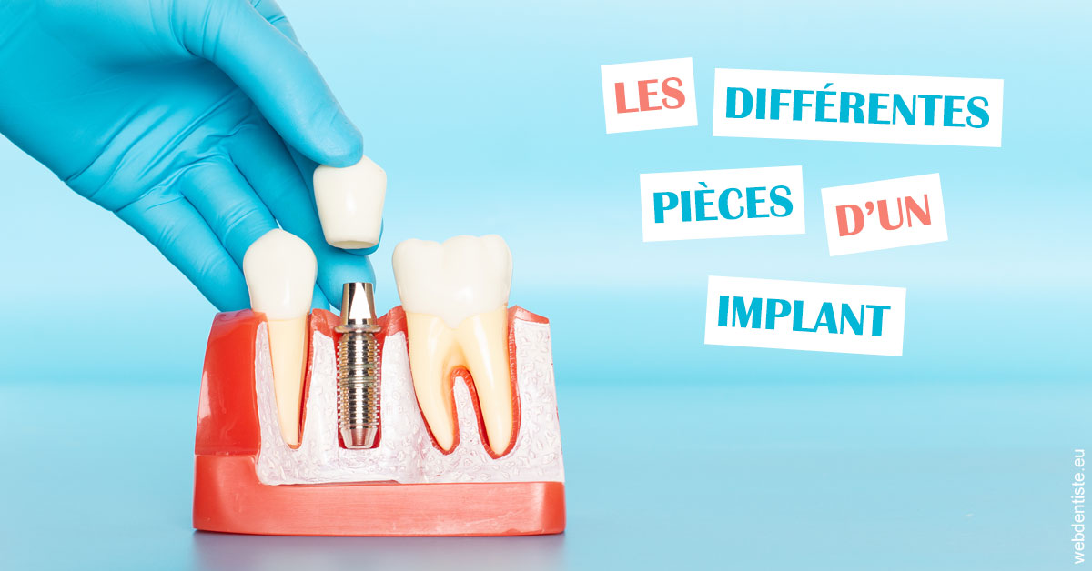 https://dr-atinault-philippe.chirurgiens-dentistes.fr/Les différentes pièces d’un implant 2