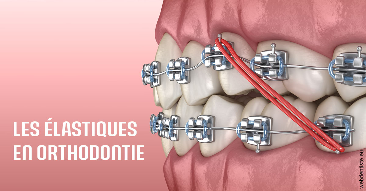 https://dr-atinault-philippe.chirurgiens-dentistes.fr/Elastiques orthodontie 2