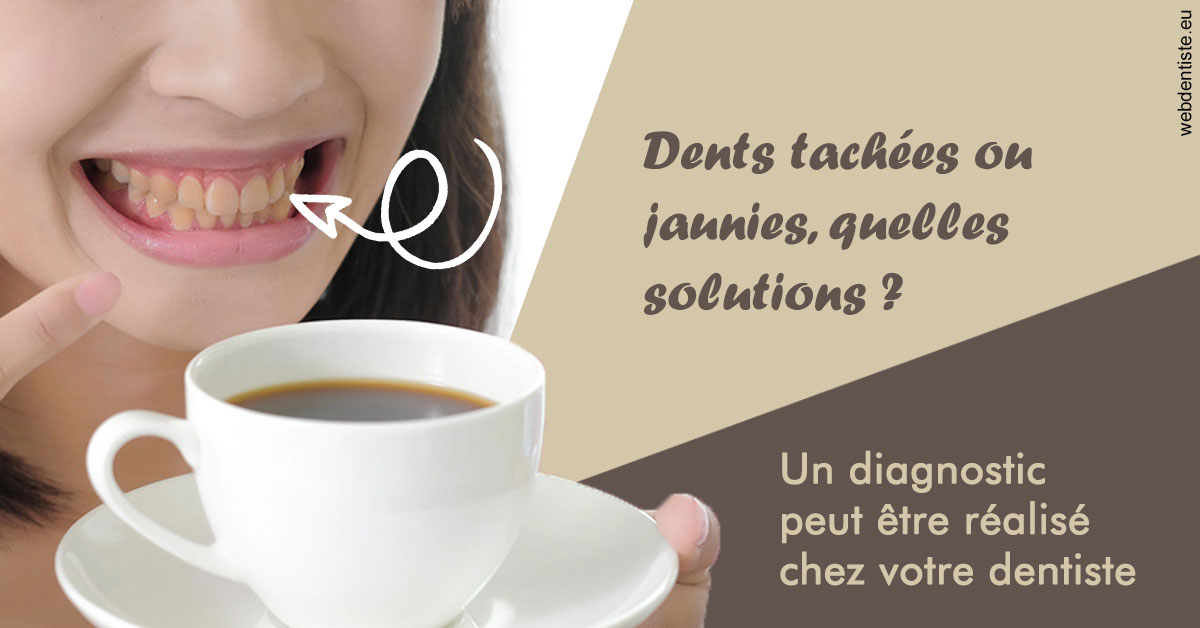 https://dr-atinault-philippe.chirurgiens-dentistes.fr/Dents tachées 1