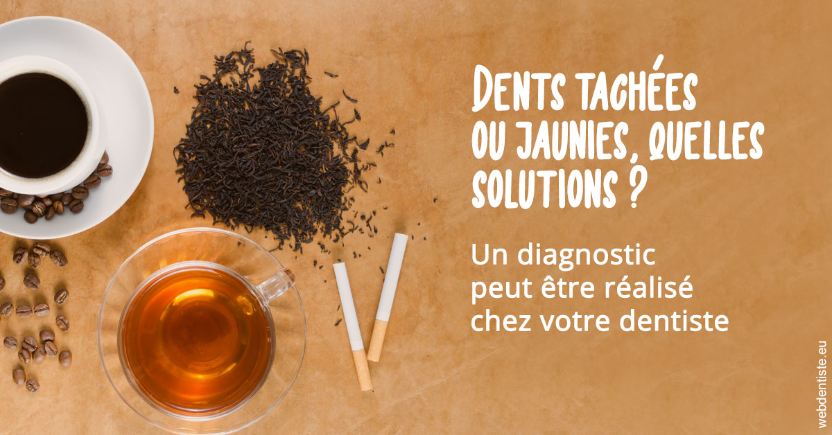 https://dr-atinault-philippe.chirurgiens-dentistes.fr/Dents tachées 2
