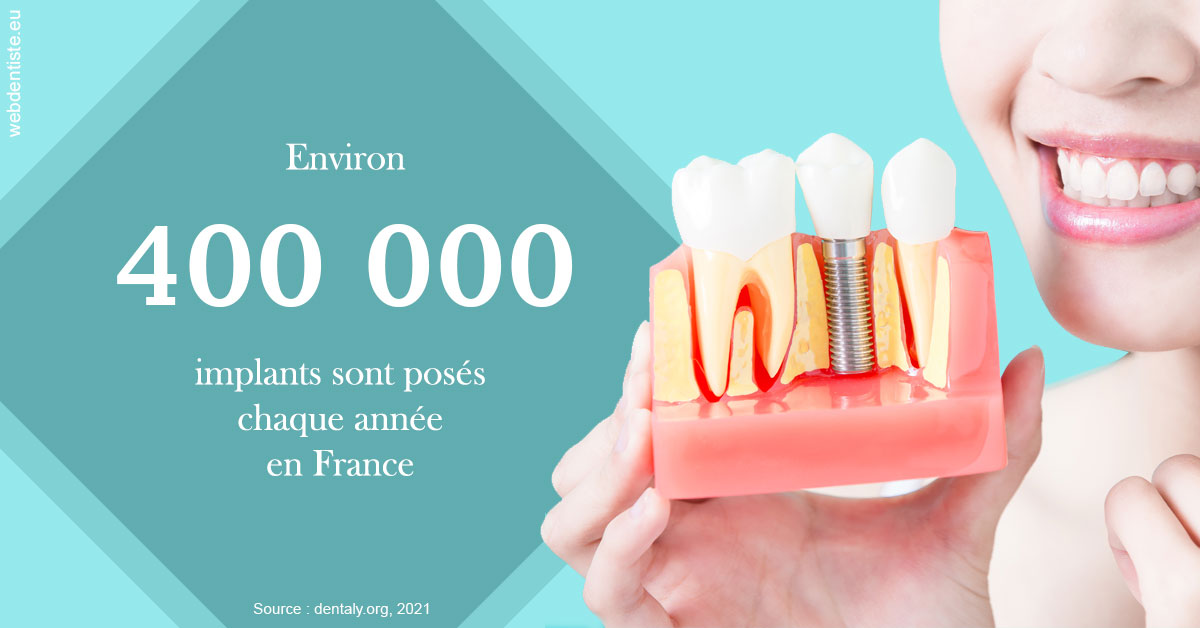 https://dr-atinault-philippe.chirurgiens-dentistes.fr/Pose d'implants en France 2